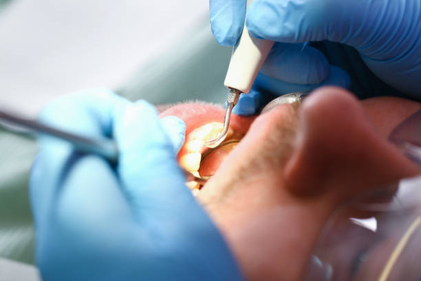 Best Emergency Broken Tooth Repair in Swartz, LA